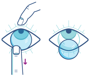 Acuvue_touchloweredge_Illustration-min-e1617797572881